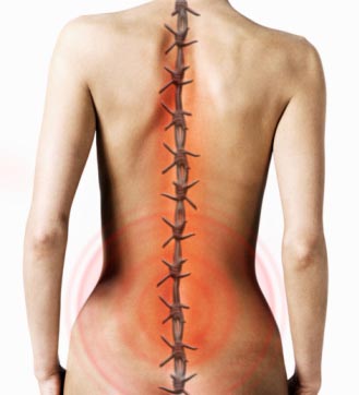 Back Pain treatment specialist vivekanantha homeo clinic dr.senthil kumar Vivekanantha homeopathy clinic & psychological counseling center, Velachery, Chennai, panruti, cuddalore, Pondicherry, villupuram, Dr.senthil kumar best homeopathy specialist & famous psychologist in tamilnadu, india, 