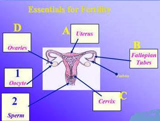 infertility female குழந்தையின்மை குழந்தையின்மை அல்லது மலட்டுத்தன்மை என்பது மானுட சமுதாயத்தில் பரவலாகக் காணப்படுகின்ற ஒரு துயரப்படுத்தும் குறையாகும். இது தம்பதியர்களை பெரிதும் பாதிப்புக்குள்ளாக்குகிறது. வாழ்க்கையில் வெறுமை, ஏமாற்றம் பெண்களைப் பொறுத்தமட்டில் நாம் தாய்மை அடைய முடியவில்லையே என்ற ஏக்கமும் மலடி என்று சமுதாயம் கொடுக்கும் பட்டமும் அவர்கள் மனதைப் பாதிக்கின்றன. இதனால் சிலர் தற்கொலை முயற்சியில் கூட ஈடுபடுகின்றனர். ஆண்களைப் பொறுத்தவரை நம்மால் ஒரு குழந்தைக்குத் தகப்பன் ஆக முடியவில்லையே என்ற ஆதங்கம் மற்றும் சமுதாயம் கூறும் வன்மையான சொற்கள் எல்லாம் சேர்ந்து குடும்ப வாழ்க்கையைக் கூட சீர்குலையச் செய்து கணவன் மனைவி உறவில் விரிசல் ஏற்படுத்தி விவாகரத்தில் கூட முடியும்படியாய் செய்து விடுகிறது. இந்த குழந்தையின்மைக்கான காரணங்ளை நாம் ஆராய்ந்து பார்க்கும் போது ஆண்களைப் பொறுத்தவரை சில பிறவிக் குறைபாடுகள் தவிர சுற்றுச் சூழலில் ஏற்படும் மாசுவினாலும், கெமிக்கல் தொழிற்சாலைகள், ஆஸபெஸ்ட்டாஸ் தொழிற்சாலைகள், சுரங்கங்கள் மற்றும் ஆழ்கடல் மூழ்குதல் போன்ற தொழில்களில் ஈடுபடுபம் ஆண்களுக்கு விந்துவில் உயிரணுக்களின் எண்ணிக்கை குறைந்து மலட்டுத்தன்மை ஏற்பட ஏதுவாகிறது. மேலும் சிறுவயதில் ஏற்பட்ட புட்டாலம்மை, சின்னம்மை போன்றவைகளின் தாக்கமும் மற்றும் சிலருக்கு ஏற்பட்ட பால்வினை நோய்களின் தாக்கமும் உயிரணுக்களின் வீரியத்தை குறைத்தும் அணுக்கள் வெளியேறாது தடைகள் ஏற்படுத்தியும் மலட்டுத்தன்மையை உண்டுபண்ணுகிறது. பெண்களைப் பொறுத்தவரை குழந்தையின்மைக்கான காரணங்கள் ஆண்களைவிட சற்று அதிகமாகவே காணப்படுகிறது. உளவியல் ரீதியாக பார்க்கும் போது இளவயது திருமணம், மனபக்குவம் அடையாமல் தாம்பத்ய உறவை நினைத்து பயம், அருவருப்பு, மன உளைச்சல், மன இறுக்கம், மன வேதனை, இன்றைய பரபரப்பான வாழ்க்கை முறை, உணவு பழக்க வழக்கங்கள், வேகமும் மன அழுத்தமும் உள்ள எந்திர வாழ்க்கை போன்றவை காரணங்களாகின்றன. உறுப்புகளின் குறைபாடுகள் :  உறுப்புகளின் குறைபாடுகள் ரீதியாகப் பார்க்கும் போது  கன்னித்திரை பிளவுபட முடியாது கடினமாய் இருத்தல் (un ruptured Hymen)  கர்ப்பப்பை, சினைப்பை, கருக்குழாய் வளர்ச்சியின்மை  கர்ப்பப்பை கட்டிகள் (Ovarian Cyst)  கர்ப்பப்பை இறக்கம்  கர்ப்பப்பை உள்தோல் பாதிப்பு (endometriosis)  வெள்ளைபடுதல்  மாதவிடாய் கோளாறுகள்  விலிமிக்க மாதவிடாய் (Dysmennorrhoea)  அதிக ரத்தப்போக்கு  தொடர்ச்சியாய் கருச்சிதைவு ஏற்படுதல் (Habitual abortion)  உடல் பருமன் (Obesity)  சுரப்பி இயக்கக் கோளாறுகளால் ஏற்படும் ஹார்மோன் ஏற்றத்தாழ்வுகள்  தைராய்டு போன்றவைகள் காரணமாய் அமைகின்றன. மேலும் பிறப்பு உறுப்புகளில் தொற்று நோய்கள், பால்வினை நோய்கள் போன்றவைகளால் ஏற்படும் குறைபாடுகள் கூட காரணங்களாய் அமைகின்றன. குழந்தையின்மை ஹோமியோபதி சிகிச்சைக்கு தொடர்பு கொள்ளவும் ஹோமியோபதி சிறப்பு மருத்துவர் செந்தில் குமார் தண்டபாணி அவர்களிடம் இதைப்போன்ற குழந்தையின்மை பிரச்சனைகளுக்கு சிகிச்சை பெற்று பலர் நல்ல பலனடைந்திருக்கிறார்கள். மருத்துவர் செந்தில் குமார் அவர்களை சென்னை, வேளச்சேரி விவேகானந்தா ஹோமியோபதி கிளினிக் & உளவியல் ஆலோசனை மையத்தில் சந்திக்கலாம். முன்பதிவு அவசியம். முன்பதிவிற்கு தொடர்புகொள்ளவும் 9786901830, மின் அஞ்சல்: consult.ur.dr@gmail.com மேலும் விபரங்களுக்கும் ஆலோசனைக்கும் சிகிச்சைக்கும் தொடர்பு கொள்க விவேகானந்தா கிளினிக் ஆலோசனை மையங்கள் & தொடர்பு எண்கள் சென்னை:- 9786901830 பண்ருட்டி:- 9443054168 புதுச்சேரி:- 9865212055 (Camp) மின் அஞ்சல் : consult.ur.dr@gmail.com, homoeokumar@gmail.com முன்பதிவிற்கு அழைக்கவும் அல்லது மின் அஞ்சல் அனுப்பவும். முன்பதிவிற்கு: உங்களின் பெயர் - வயது – அலைபேசி எண் – பிரச்சனை (ஒரு வரியில்) தேதி – கிழமை – இடம், முதலியவற்றை குறுந்தகவல் மூலம் அனுப்பவும். உதாரணம்: ரம்யா - 28 – 99******00 – குழந்தையின்மை – 20-12-2014 – சனிக்கிழமை – சென்னை, மருத்துவர் உங்களின் முன்பதிவை குறுந்தகவல் மூலம் உறுதிப்படுத்துவார்.